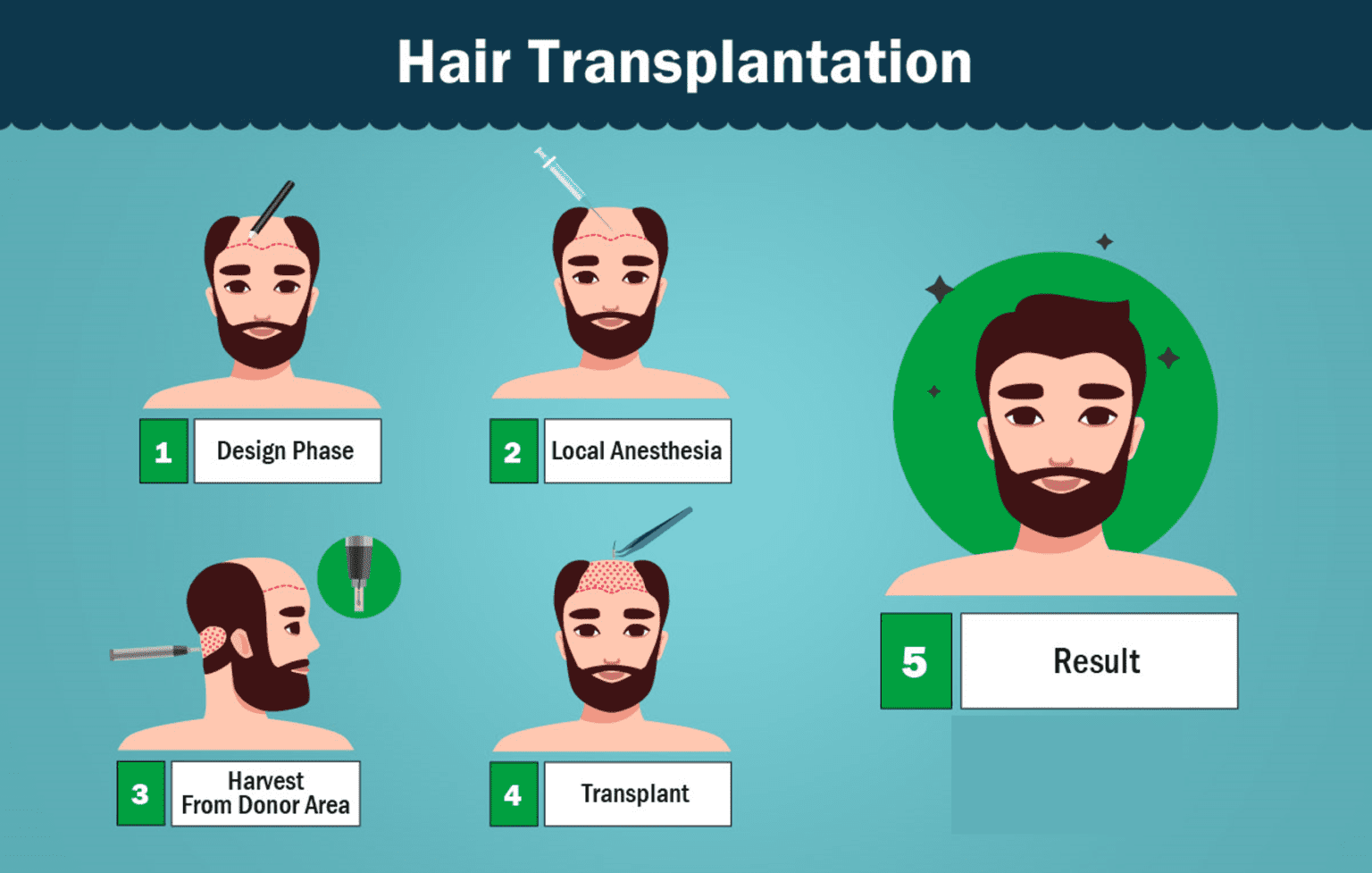 What is Hair Transplant 1536x977 1 SARAYU CLINICS Hair Transplant in Delhi