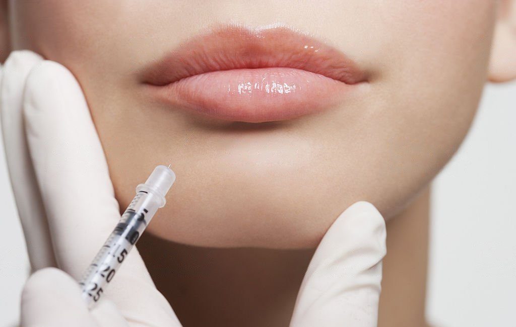 Lip Augmentation Treatment in Delhi transformed SARAYU CLINICS Lip Augmentation in Delhi