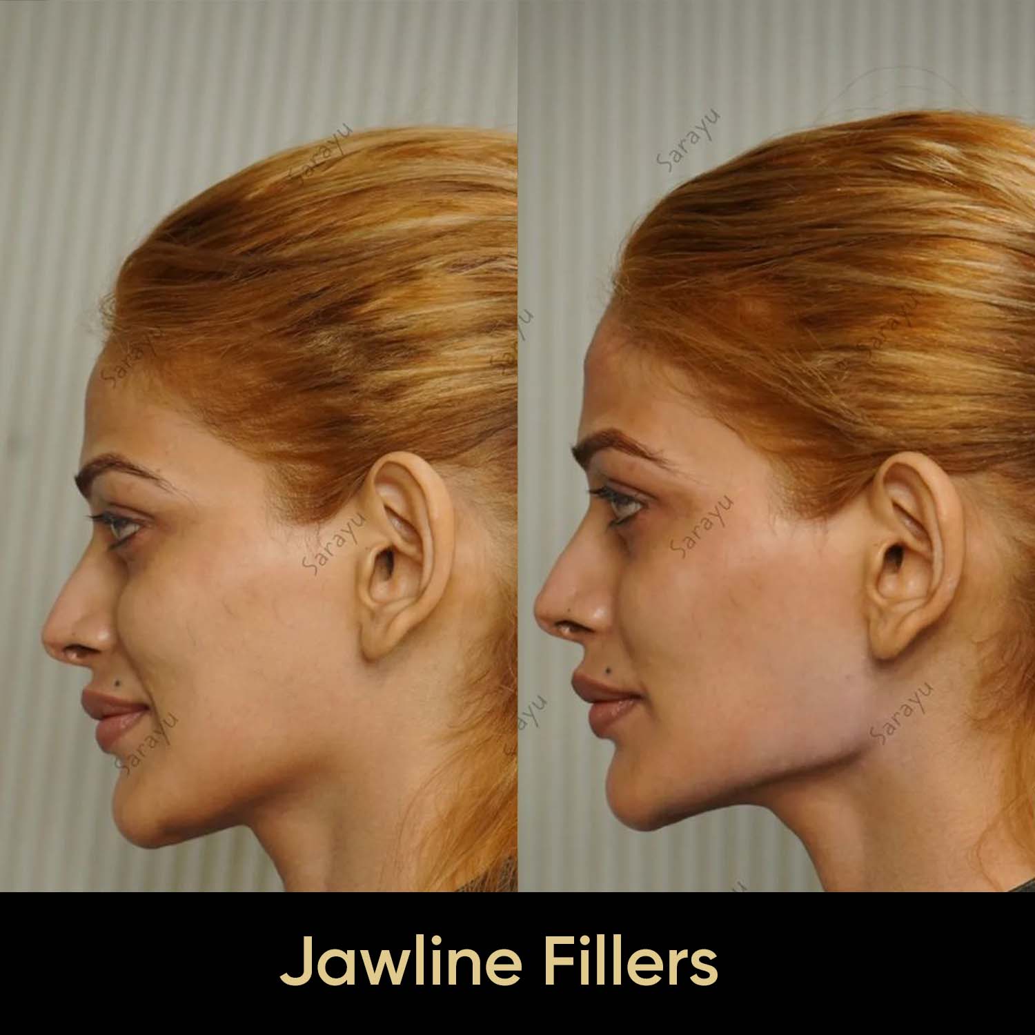 Close-up of a person with a slightly more defined jawline.