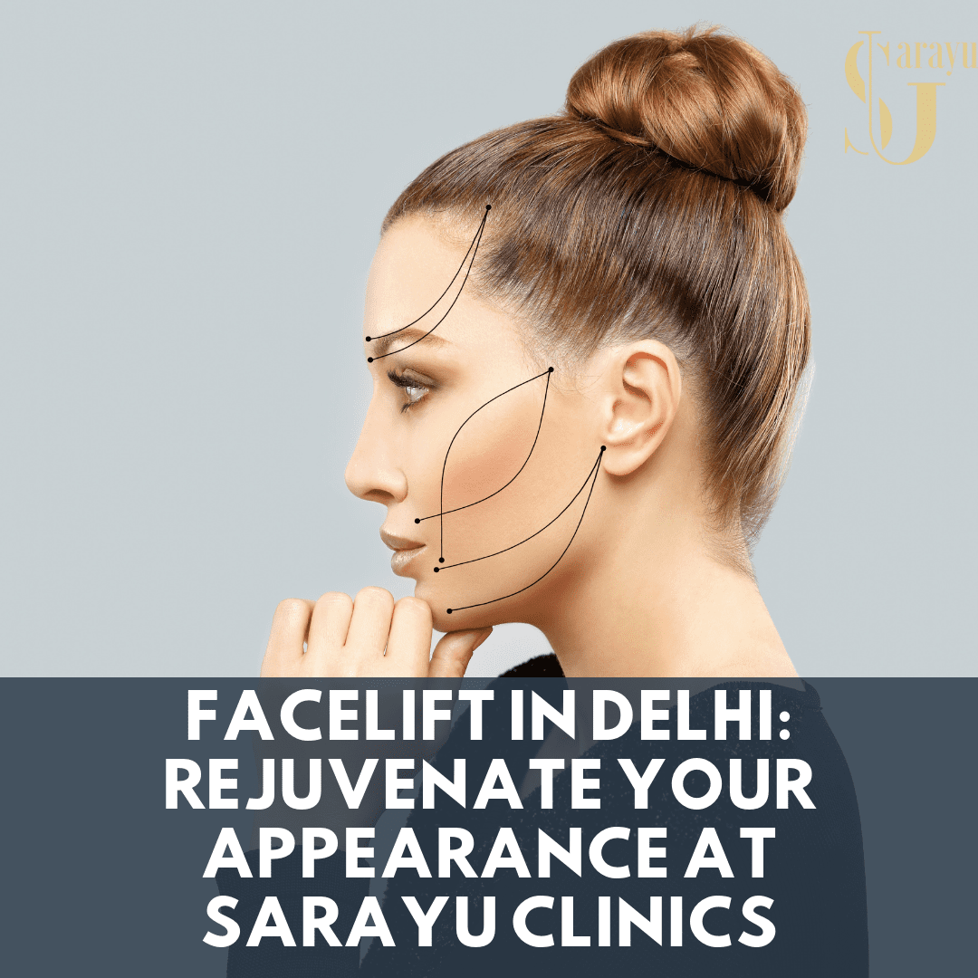 Facelift in Delhi - Rejuvenate Your Appearance at Sarayu Clinics