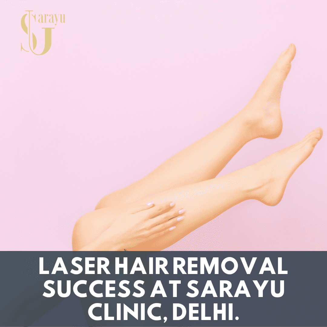 Smiling client with smooth skin after getting the Best Laser Hair Removal in Delhi at Sarayu Clinic.