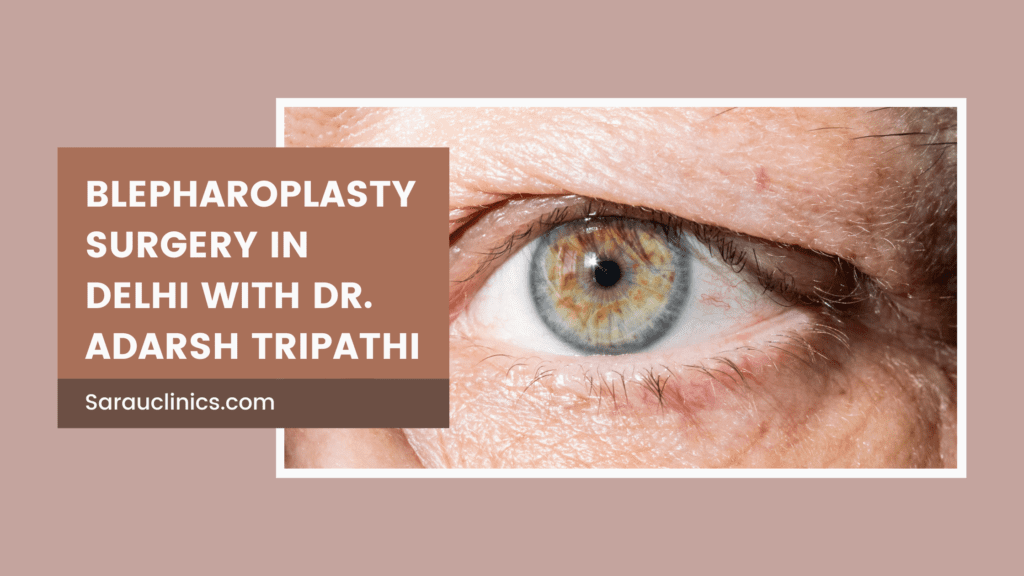 Blepharoplasty Surgery in Delhi with Dr. Adarsh Tripathi SARAYU CLINICS Blepharoplasty Surgery in Delhi