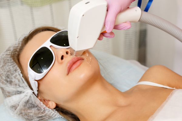 Patient receiving laser hair removal treatment at Sarayu Clinics in Greater Kailash, Delhi.