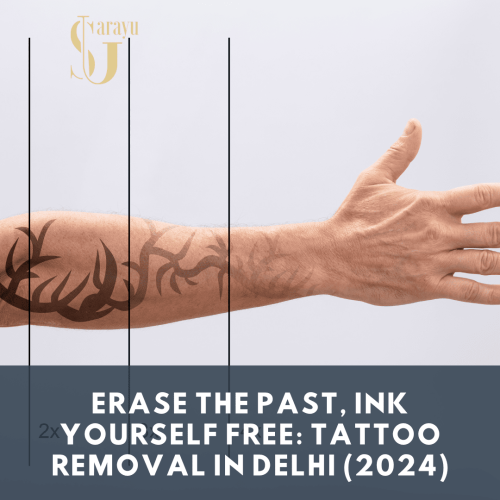 At Sarayu Clinics, we utilize cutting-edge lasers and experienced dermatologists to ensure safe and effective tattoo removal tailored to your needs.